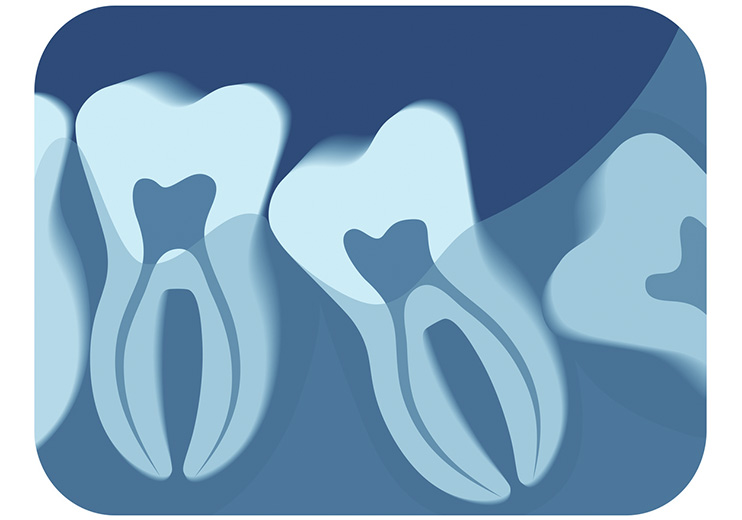 Cirugia-bucal-y-maxilofacial