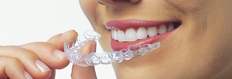 ortodoncia invisalign