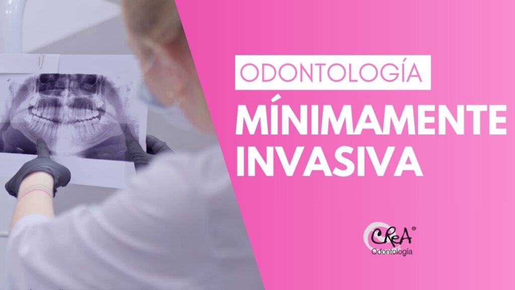 Odontología Mínimamente Invasiva