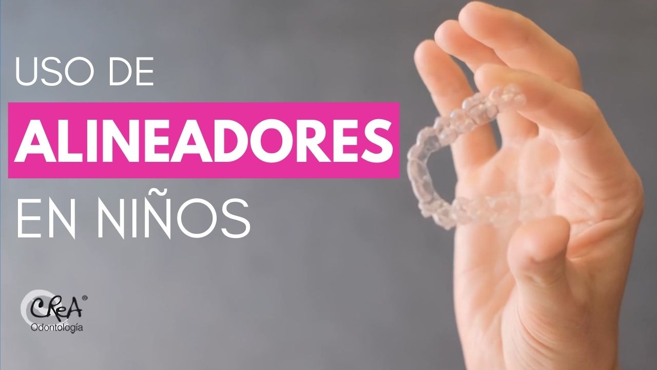 Uso de alineadores en niños