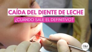 Caída del diente de leche ¿cuándo sale el definitivo?