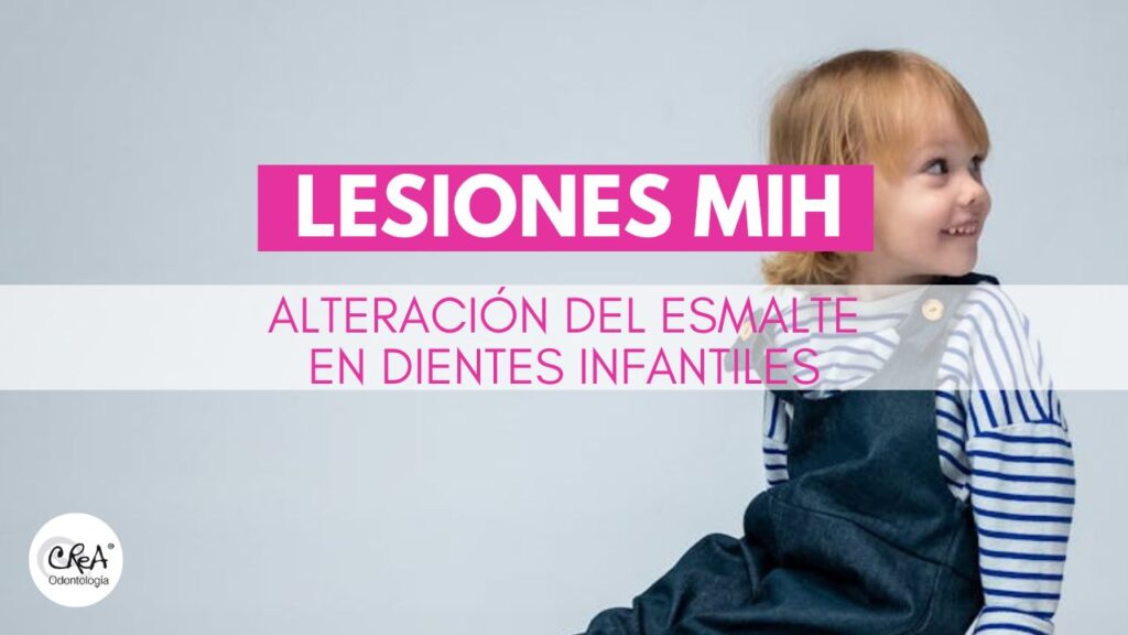 Lesiones MIH, alteración del esmalte en dientes infantiles