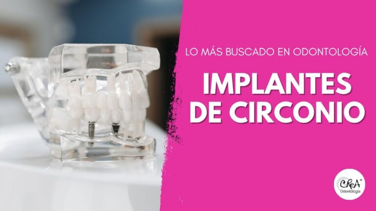 implantes de circonio